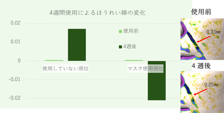 ほうれい線の深さの改善を示す試験データ